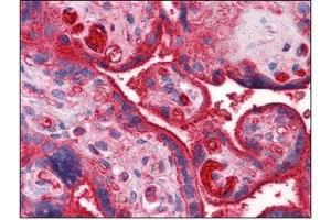 Immunohistochemistry (IHC) image for anti-Apolipoprotein A-II (APOA2) (AA 1-101) antibody (ABIN614396) (APOA2 antibody  (AA 1-101))