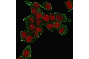 Immunofluorescence staining of HePG2 cells using TNF alpha Mouse Monoclonal Antibody (TNF706) followed by goat anti-mouse IgG-CF488 (green). (TNF alpha antibody  (N-Term))