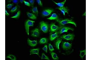 Immunofluorescence staining of A549 cells with ABIN7169288 at 1:66, counter-stained with DAPI. (PP5 antibody  (AA 370-488))