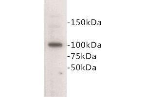 Western Blotting (WB) image for anti-Cadherin 1, Type 1, E-Cadherin (Epithelial) (CDH1) (Extracellular) antibody (ABIN1854887) (E-cadherin antibody  (Extracellular))