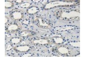 Detection of PSMC4 in Human Kidney Tissue using Polyclonal Antibody to Proteasome 26S Subunit, ATPase 4 (PSMC4) (PSMC4 antibody  (AA 1-418))