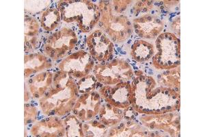 IHC-P analysis of kidney tissue, with DAB staining. (ECT2 antibody  (AA 453-647))