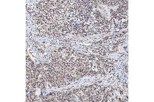 IHC analysis of U1A/SNRPA using anti-U1A/SNRPA antibody (ABIN7600891). (SNRPA1 antibody  (AA 25-218))