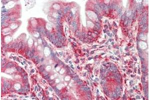 Human Small Intestine: Formalin-Fixed, Paraffin-Embedded (FFPE) (TWEAK antibody  (Pro73))