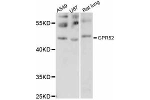 Western blot analysis of extracts of various cell lines, using GPR52 antibody (ABIN6292090) at 1:1000 dilution. (GPR52 antibody)