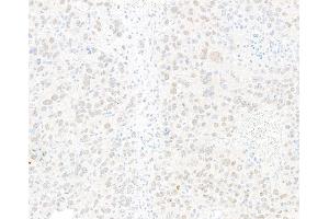 Immunohistochemistry (IHC) image for anti-Jun Dimerization Protein 2 (JDP2) (AA 50-100) antibody (ABIN7795635)