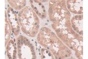 Immunohistochemistry (IHC) image for anti-ATPase, Cu++ Transporting, beta Polypeptide (ATP7B) (AA 59-426) antibody (ABIN7441340)