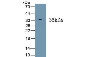 Detection of Recombinant HPS6, Human using Polyclonal Antibody to Hermansky Pudlak Syndrome Protein 6 (HPS6) (HPS6 antibody  (AA 500-775))