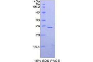 SDS-PAGE analysis of Mouse Thyroid Peroxidase Protein. (Thyroperoxidase Protein)
