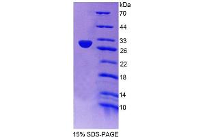 SDS-PAGE (SDS) image for NLR Family, Apoptosis Inhibitory Protein (NAIP) (AA 923-1148) protein (His tag) (ABIN6236755)