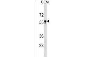 I5 Antibody (C-term) 18825b western blot analysis in CEM cell line lysates (35 μg/lane). (Apoptosis Inhibitor 5 antibody  (C-Term))