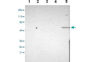 Western blot analysis of Lane 1: RT-4, Lane 2: U-251 MG, Lane 3: A-431, Lane 4: Liver, Lane 5: Tonsil with ELF1 polyclonal antibody. (ELF1 antibody)