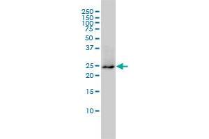 GRB2 monoclonal antibody (M01A), clone 4C6-H6 Western Blot analysis of GRB2 expression in HL-60 .