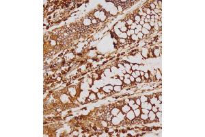 Immunohistochemical analysis of (ABIN1539214 and ABIN2838155) on paraffin-embedded human colon tissue was performed on the Leica®BOND RXm. (GATSL2 antibody  (N-Term))