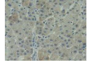 Figure. (ITGAD antibody  (AA 879-1099))