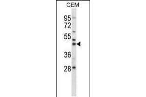 Western blot analysis in CEM cell line lysates (35ug/lane). (MEK2 antibody  (N-Term))