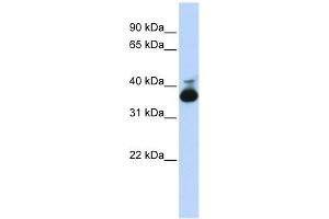 ALDOB antibody used at 1 ug/ml to detect target protein. (ALDOB antibody  (Middle Region))