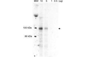 Western blot analysis of MLXIPL in liver nuclear extracts from well-fed rats. (MLXIPL antibody  (AA 800-852))