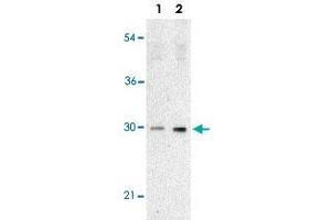 Western blot analysis of TP53INP1 expression in human lung tissue lysate with TP53INP1 polyclonal antibody  at 2 ug/mL in the absence (lane 1) or presence (lane 2) of blocking peptide.