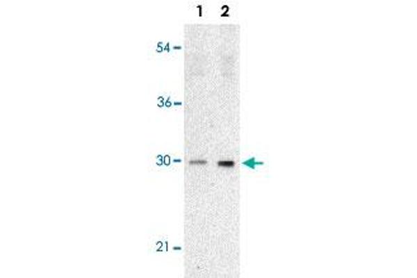 TP53INP1 antibody  (C-Term)