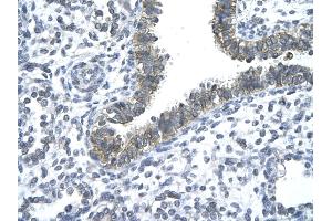 Immunohistochemistry (IHC) image for anti-CCR4 Carbon Catabolite Repression 4-Like (CCRN4L) (N-Term) antibody (ABIN2779705)