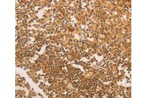 Immunohistochemistry (IHC) image for anti-Telomerase Reverse Transcriptase (TERT) antibody (ABIN1875058) (TERT antibody)