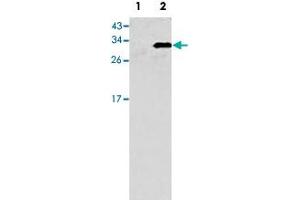 Western blot analysis of GJB6 (arrow) using GJB6 polyclonal antibody . (GJB6 antibody  (N-Term))
