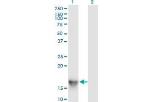 Western Blot analysis of SH2D1A expression in transfected 293T cell line by SH2D1A monoclonal antibody (M01), clone 1C9. (SH2D1A antibody  (AA 1-128))