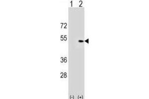 Western Blotting (WB) image for anti-Pleckstrin Homology Domain Containing, Family A (phosphoinositide Binding Specific) Member 1 (PLEKHA1) antibody (ABIN3000047)
