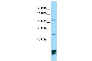 WB Suggested Anti-CTNND2 Antibody Titration: 1. (CTNND2 antibody  (C-Term))