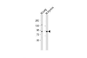 Western Blot at 1:1000 dilution Lane 1: mouse lung lysate Lane 2: mouse thymus lysate Lysates/proteins at 20 ug per lane.