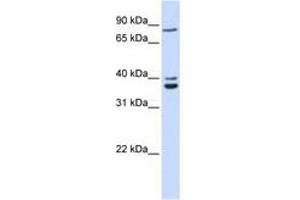 Image no. 1 for anti-Chromosome 18 Open Reading Frame 10 (C18orf10) (AA 108-157) antibody (ABIN6741301) (TPGS2 antibody  (AA 108-157))
