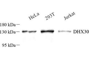 Western blot analysis of DHX30 (ABIN7073703) at dilution of 1: 250