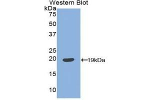 Detection of Recombinant IGFBP3, Bovine using Polyclonal Antibody to Insulin Like Growth Factor Binding Protein 3 (IGFBP3) (IGFBP3 antibody  (AA 106-241))