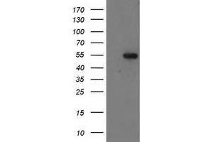 Western Blotting (WB) image for anti-Glucosidase, Beta, Acid 3 (Cytosolic) (GBA3) (AA 1-150), (AA 370-469) antibody (ABIN1490583) (GBA3 antibody  (AA 1-150, AA 370-469))