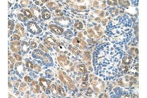 SLC22A16 antibody was used for immunohistochemistry at a concentration of 4-8 ug/ml to stain EpitheliaI cells of renal tubule (arrows) in Human Kidney. (SLC22A16 antibody)