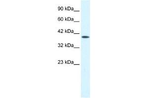 P2RX2 antibody used at 0. (P2RX2 antibody  (Middle Region))