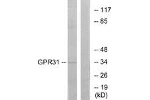 Western blot analysis of extracts from COLO cells, using GPR31 Antibody. (GPR31 antibody  (AA 181-230))