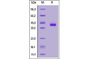 SDS-PAGE (SDS) image for Poliovirus Receptor-Related 4 (PVRL4) (AA 32-349) (Active) protein (His tag,FITC) (ABIN6973169)