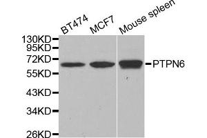 Western blot analysis of extracts of various cell lines, using PTPN6 antibody. (SHP1 antibody)