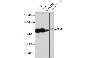 Western blot analysis of extracts of various cell lines, using TR Rabbit mAb (ABIN1680970, ABIN3018361, ABIN3018362 and ABIN7101601) at 1:1000 dilution. (TRAP1 antibody)