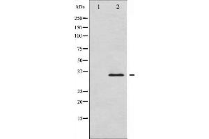 Western blot analysis of IkappaB-alpha expression in HuvEc whole cell lysates,The lane on the left is treated with the antigen-specific peptide. (NFKBIA antibody  (C-Term))