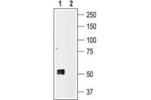 Western blot analysis of human platelet lysates: - 1. (P2RX1 antibody  (Intracellular))