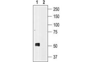 Western blot analysis of human platelet lysates: - 1. (P2RX1 antibody  (C-Term, Intracellular))