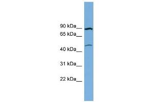 WB Suggested Anti-TMEM48 Antibody Titration:  0. (TMEM48 antibody  (Middle Region))