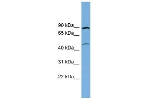 WB Suggested Anti-TMEM48 Antibody Titration:  0.