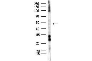 anti-Farnesyltransferase subunit beta (FNTB) (Internal Region) antibody