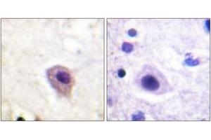 Immunohistochemistry analysis of paraffin-embedded human brain, using DRP-2 (Phospho-Thr514) Antibody. (DRP2 antibody  (pThr514))
