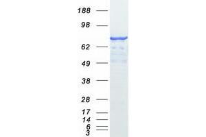 Western Blotting (WB) image for SATB Homeobox 1 (SATB1) (Transcript Variant 1) protein (Myc-DYKDDDDK Tag) (ABIN2731422)