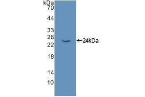 Detection of Recombinant NME6, Rat using Polyclonal Antibody to Non Metastatic Cells 6, Protein Expressed In (NME6) (NME6 antibody  (AA 1-173))